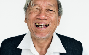台中全口重建推薦